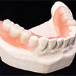 implant denture