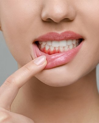 Treat gum disease and bleeding gums near Nashua