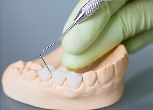 dentist working on dental bridge