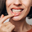 a woman showing signs of gum disease 