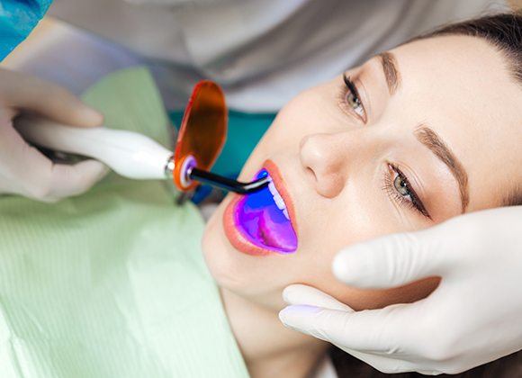 girl getting dental sealants