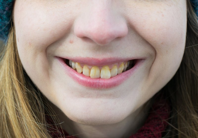A closeup of a girl with yellow teeth
