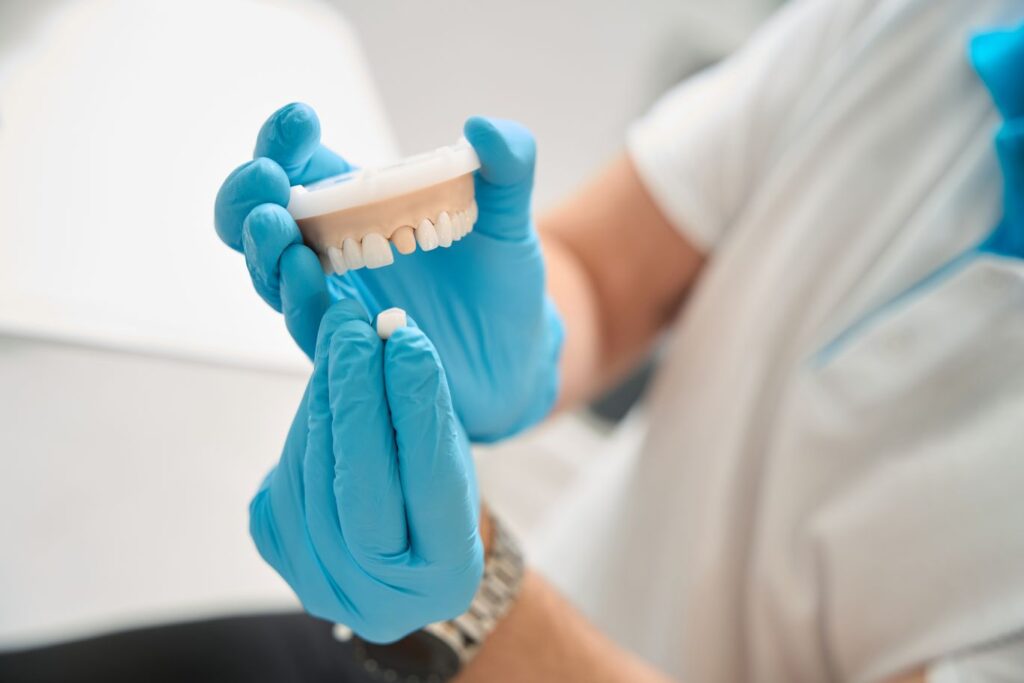A dentist using a plaster model to show how a dental crown fits on a tooth.